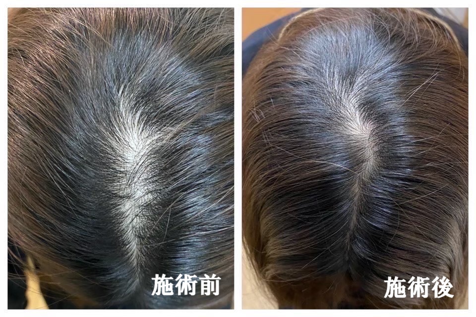 sample-02